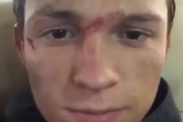 Tom Holland se machuca em cena de "Homem-Aranha: Novo Dia"